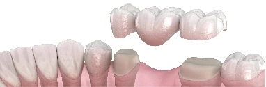 RESTORATIVE DENTISTRY