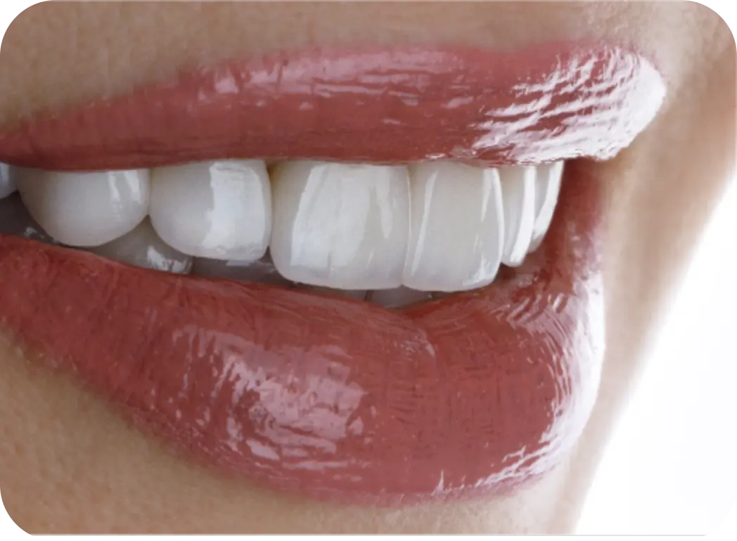 COSMETIC DENTISTRY